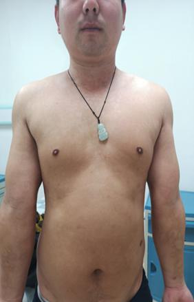 2、患者治療后的效果.jpg