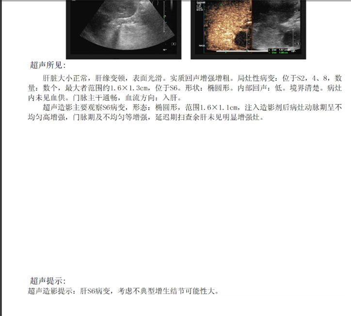 1.患者術(shù)前-超聲造影_224213.png