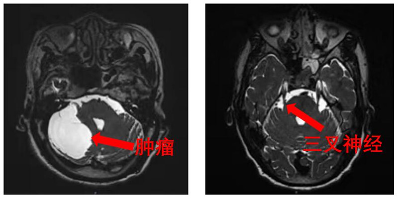 病根所在.jpg